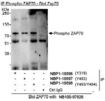 Immunoprecipitation: ZAP70 [p Tyr494] Antibody [NBP1-18898]